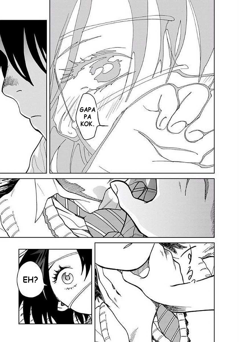 Yakedo Shoujo Chapter 05 Gambar 20