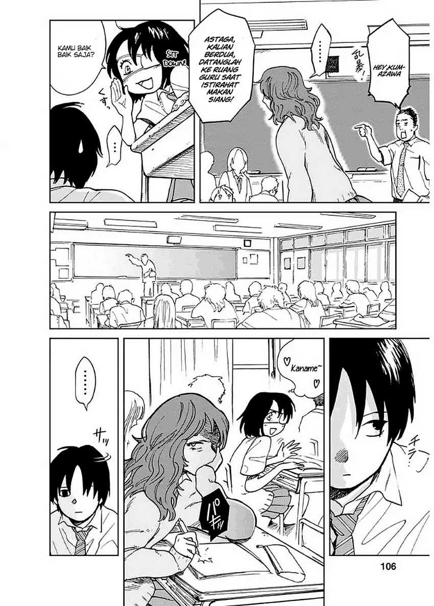 Yakedo Shoujo Chapter 04 Gambar 16