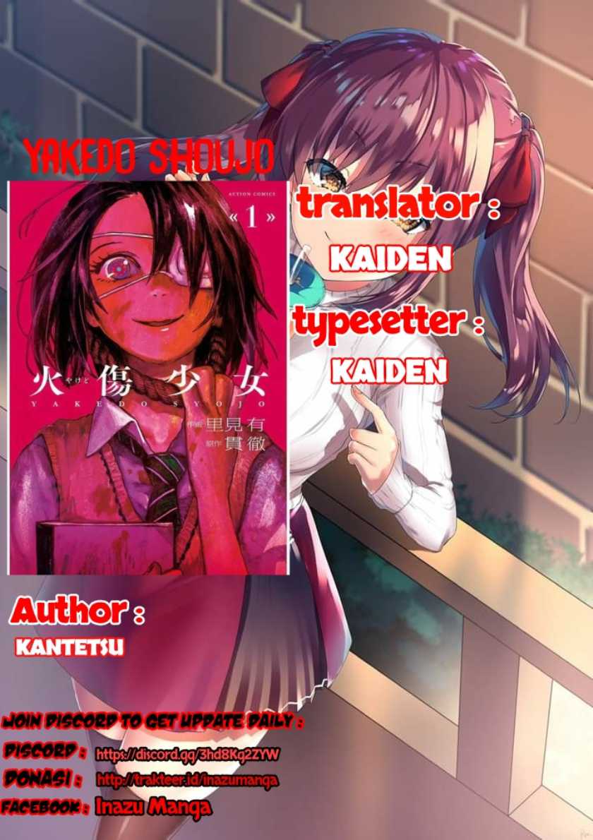 Manga Yakedo Shoujo Chapter 03 gambar nomor 2
